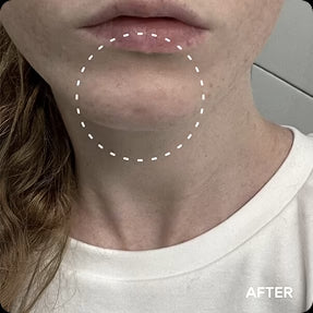 JiYu Anti-Aging Glow-Up Bundle